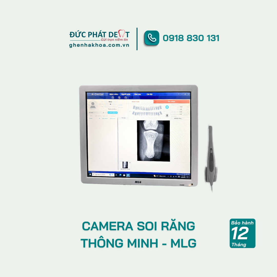 Camera soi răng thông minh MLG